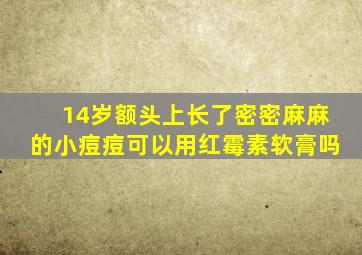 14岁额头上长了密密麻麻的小痘痘可以用红霉素软膏吗