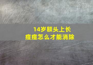 14岁额头上长痘痘怎么才能消除