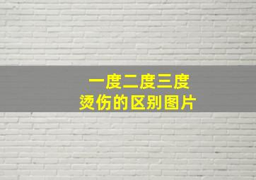 一度二度三度烫伤的区别图片