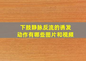 下肢静脉反流的诱发动作有哪些图片和视频