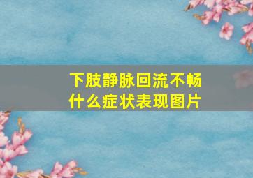 下肢静脉回流不畅什么症状表现图片