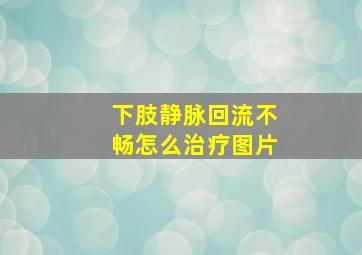 下肢静脉回流不畅怎么治疗图片