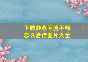 下肢静脉回流不畅怎么治疗图片大全