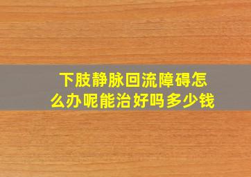 下肢静脉回流障碍怎么办呢能治好吗多少钱