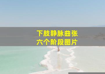 下肢静脉曲张六个阶段图片