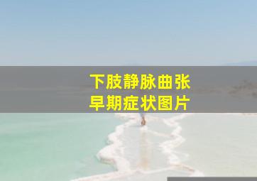 下肢静脉曲张早期症状图片