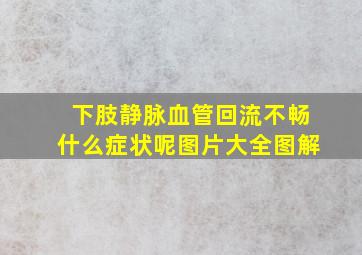 下肢静脉血管回流不畅什么症状呢图片大全图解