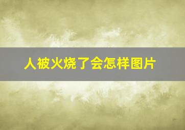 人被火烧了会怎样图片