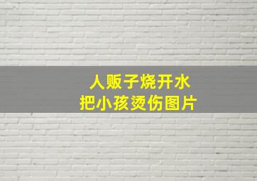 人贩子烧开水把小孩烫伤图片