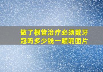 做了根管治疗必须戴牙冠吗多少钱一颗呢图片