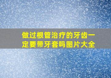 做过根管治疗的牙齿一定要带牙套吗图片大全