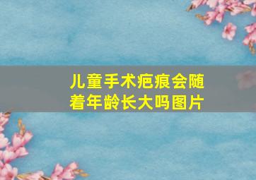 儿童手术疤痕会随着年龄长大吗图片