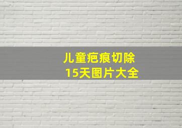 儿童疤痕切除15天图片大全