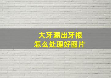 大牙漏出牙根怎么处理好图片