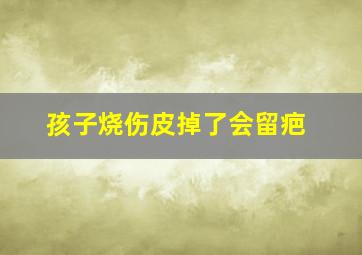 孩子烧伤皮掉了会留疤