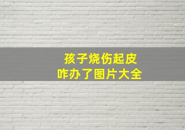 孩子烧伤起皮咋办了图片大全