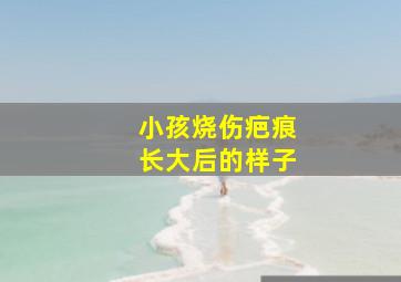 小孩烧伤疤痕长大后的样子