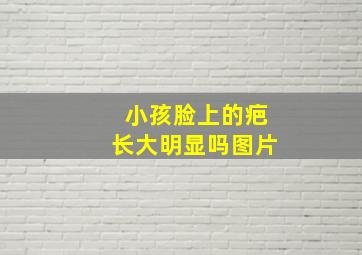 小孩脸上的疤长大明显吗图片