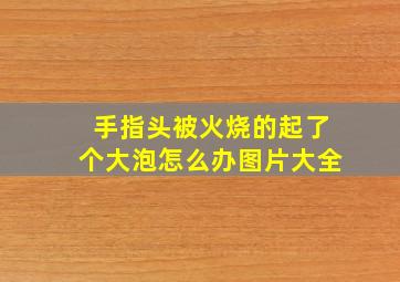 手指头被火烧的起了个大泡怎么办图片大全