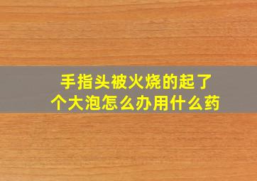 手指头被火烧的起了个大泡怎么办用什么药