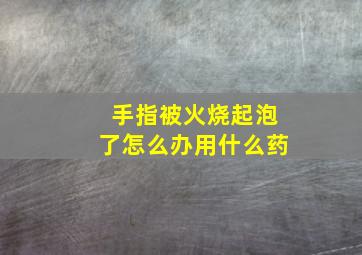 手指被火烧起泡了怎么办用什么药