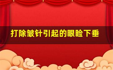 打除皱针引起的眼睑下垂