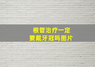 根管治疗一定要戴牙冠吗图片