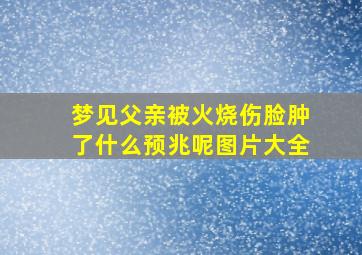 梦见父亲被火烧伤脸肿了什么预兆呢图片大全