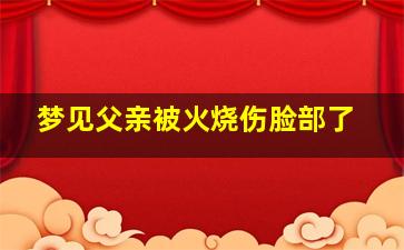 梦见父亲被火烧伤脸部了