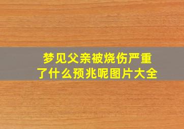 梦见父亲被烧伤严重了什么预兆呢图片大全