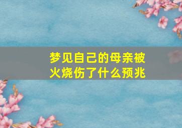 梦见自己的母亲被火烧伤了什么预兆