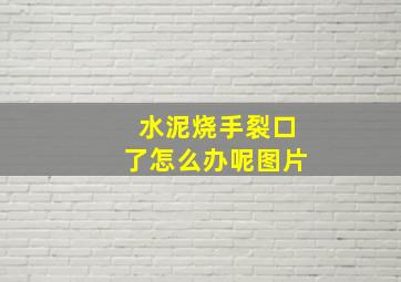 水泥烧手裂口了怎么办呢图片