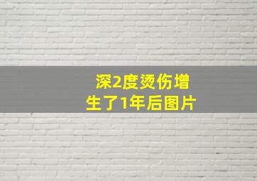 深2度烫伤增生了1年后图片