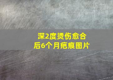 深2度烫伤愈合后6个月疤痕图片