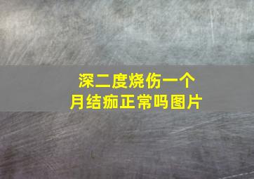 深二度烧伤一个月结痂正常吗图片