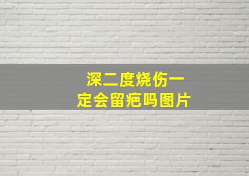 深二度烧伤一定会留疤吗图片