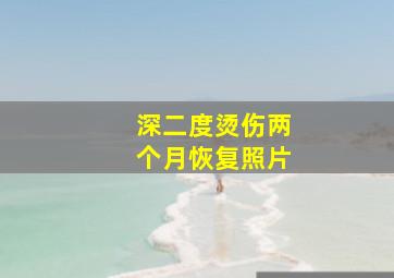 深二度烫伤两个月恢复照片