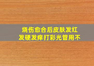 烧伤愈合后皮肤发红发硬发痒打彩光管用不