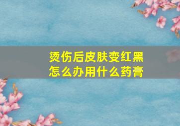 烫伤后皮肤变红黑怎么办用什么药膏