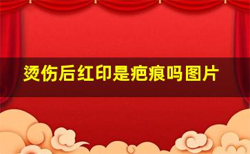 烫伤后红印是疤痕吗图片