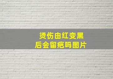 烫伤由红变黑后会留疤吗图片