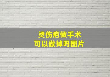 烫伤疤做手术可以做掉吗图片