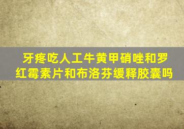 牙疼吃人工牛黄甲硝唑和罗红霉素片和布洛芬缓释胶囊吗