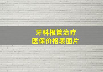 牙科根管治疗医保价格表图片