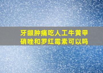 牙龈肿痛吃人工牛黄甲硝唑和罗红霉素可以吗