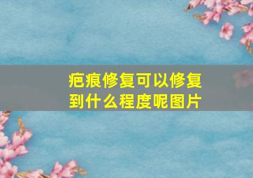 疤痕修复可以修复到什么程度呢图片