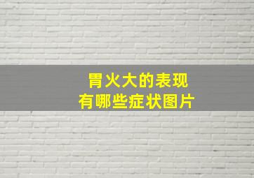 胃火大的表现有哪些症状图片