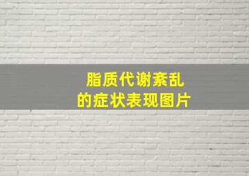 脂质代谢紊乱的症状表现图片