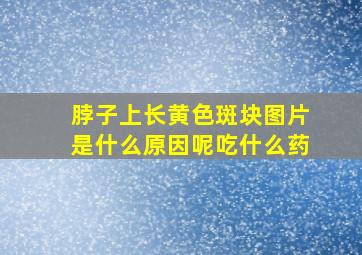 脖子上长黄色斑块图片是什么原因呢吃什么药