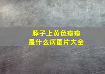 脖子上黄色痘痘是什么病图片大全